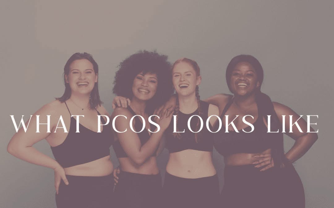 What PCOS Looks Like
